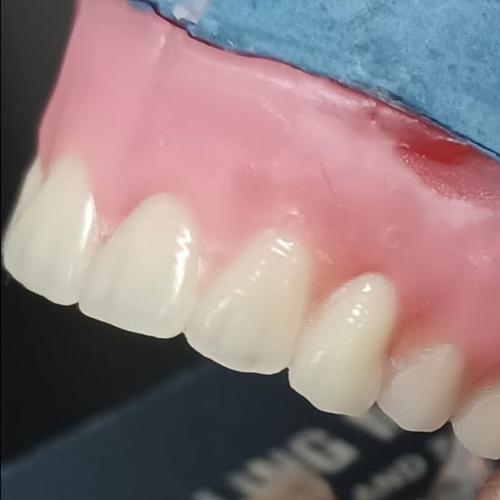 176. رص سن صناعي شمع فقط Artificial tooth