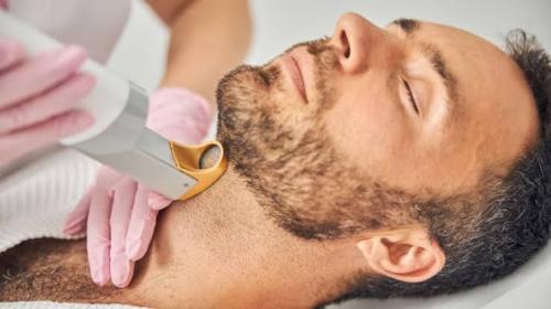 6 جلسات ليزر ازالة الشعر (الذقن +االابطين+للمنطقة...