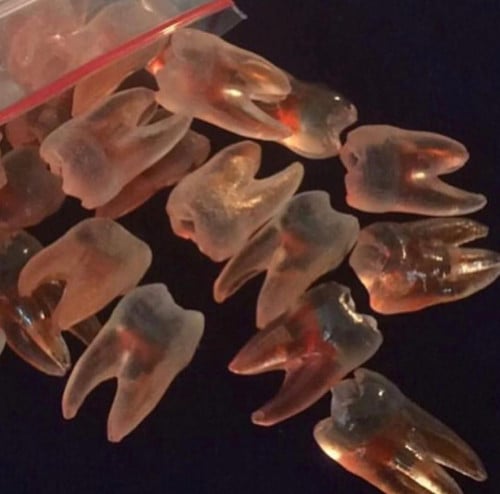 True endo teeth -اسنان عصب