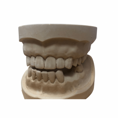 مودل جبس للدراسة -Study cast model