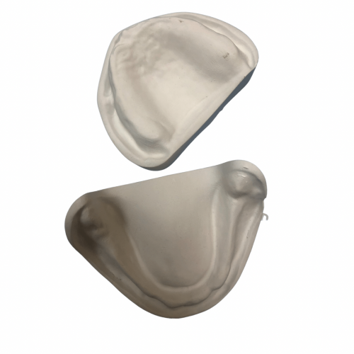 مودل جبس للدراسة بدون اسنان -Study cast model