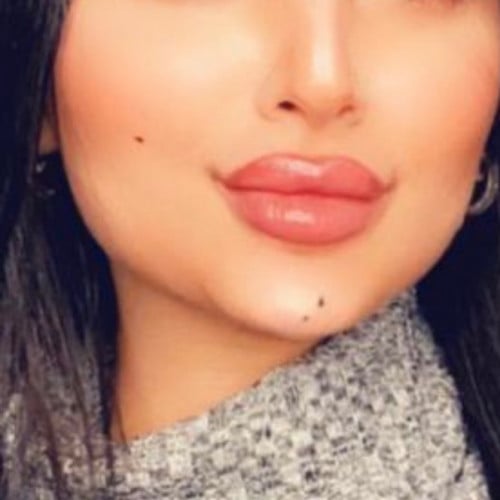 حبة خال