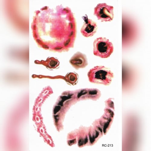 استكرات جروح للجسم