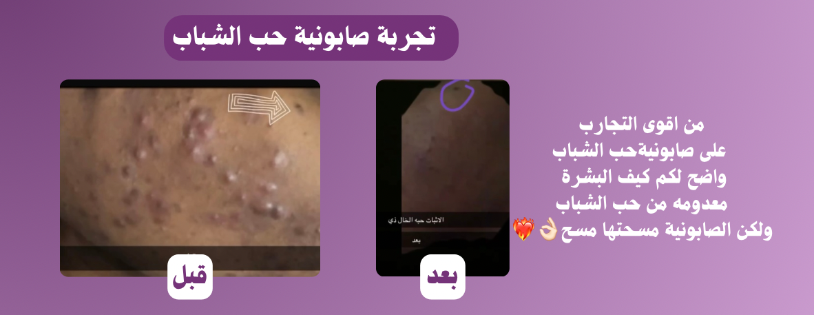 متجر الاوركيد image-slider-0