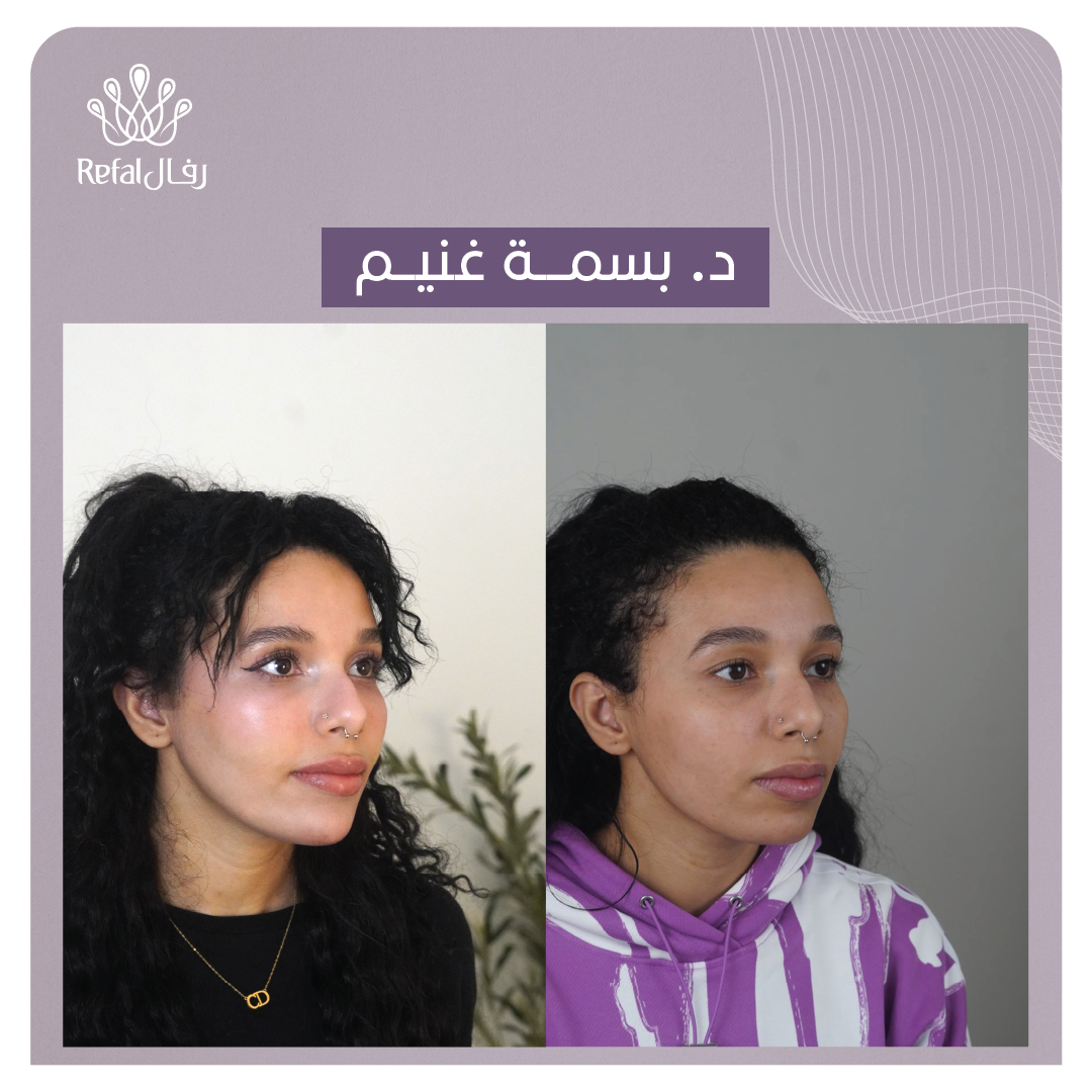 شفتي حالاتنا!