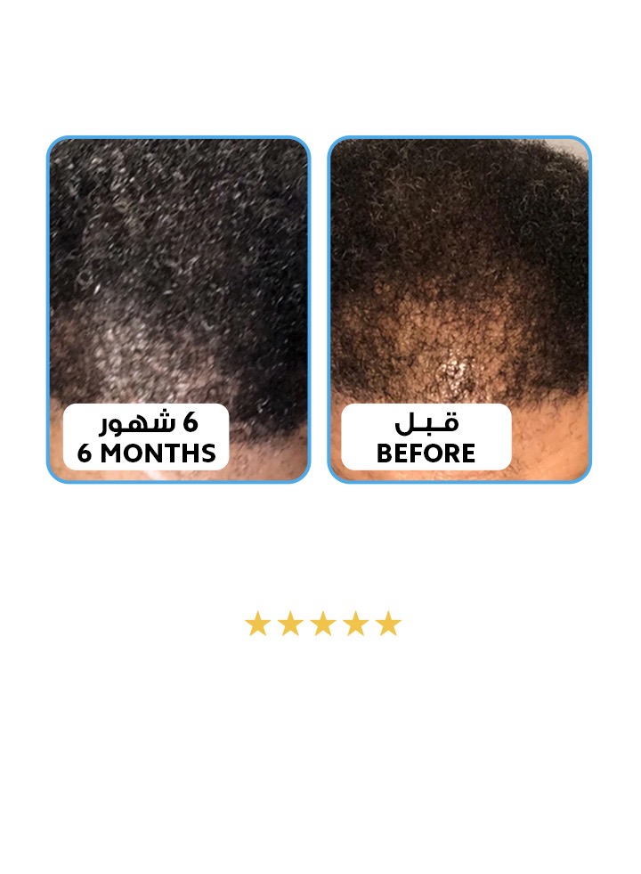 الموند هير للعناية بالشعر | Almond Hair