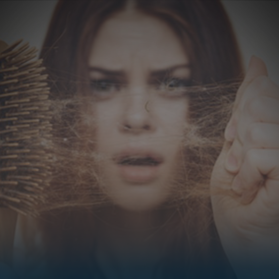 تساقط الشعر