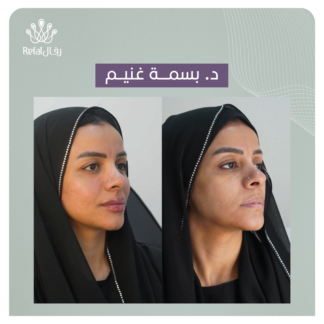 شفتي حالاتنا!
