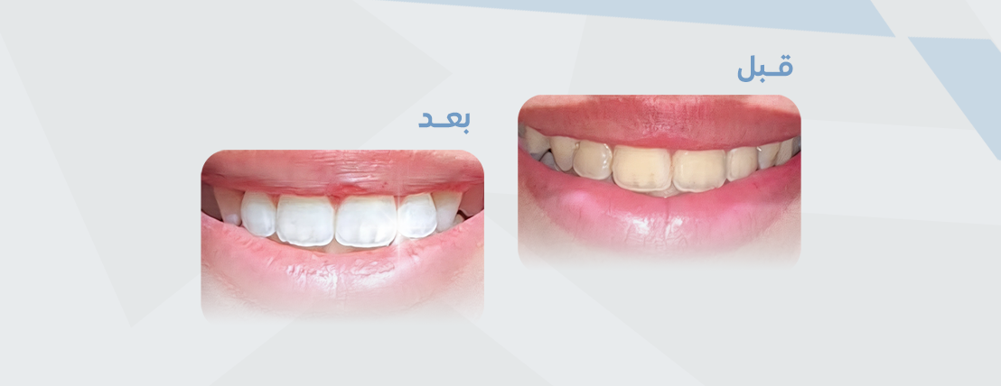 متجر ريفايل image-slider-0