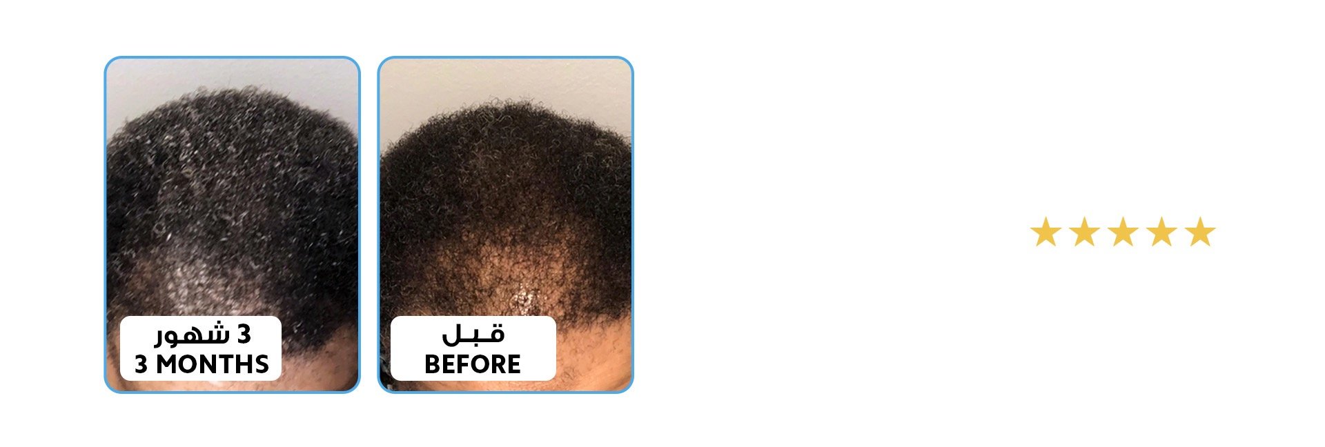 الموند هير للعناية بالشعر | Almond Hair