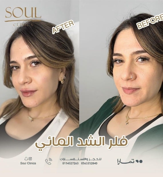 Soul clinics image-slider-1