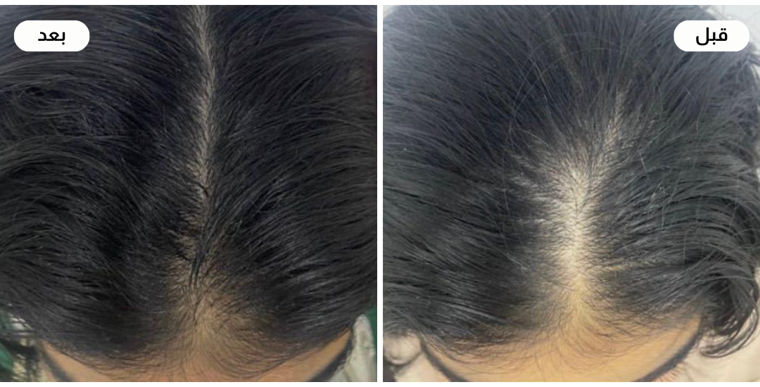 Najla care image-slider-3