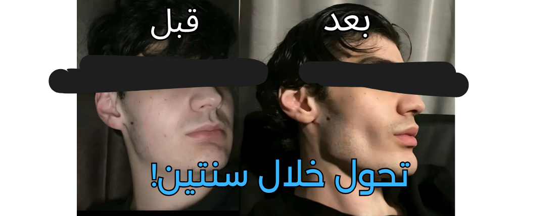 الرجل المتعافي image-slider-1