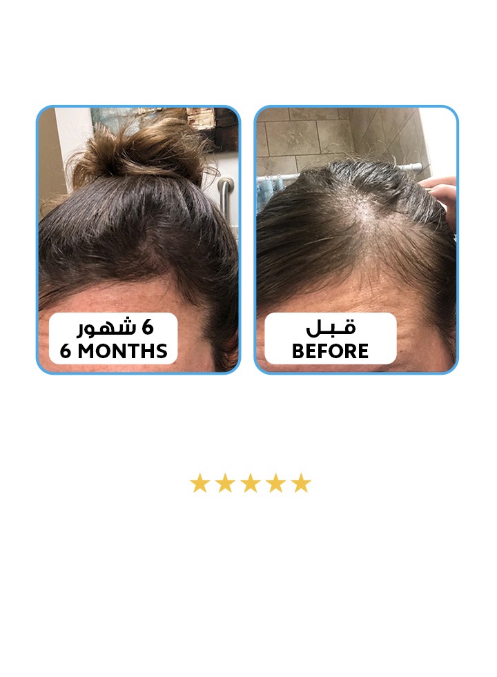 الموند هير للعناية بالشعر | Almond Hair