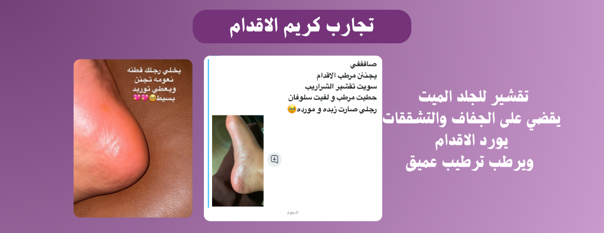 متجر الاوركيد image-slider-4