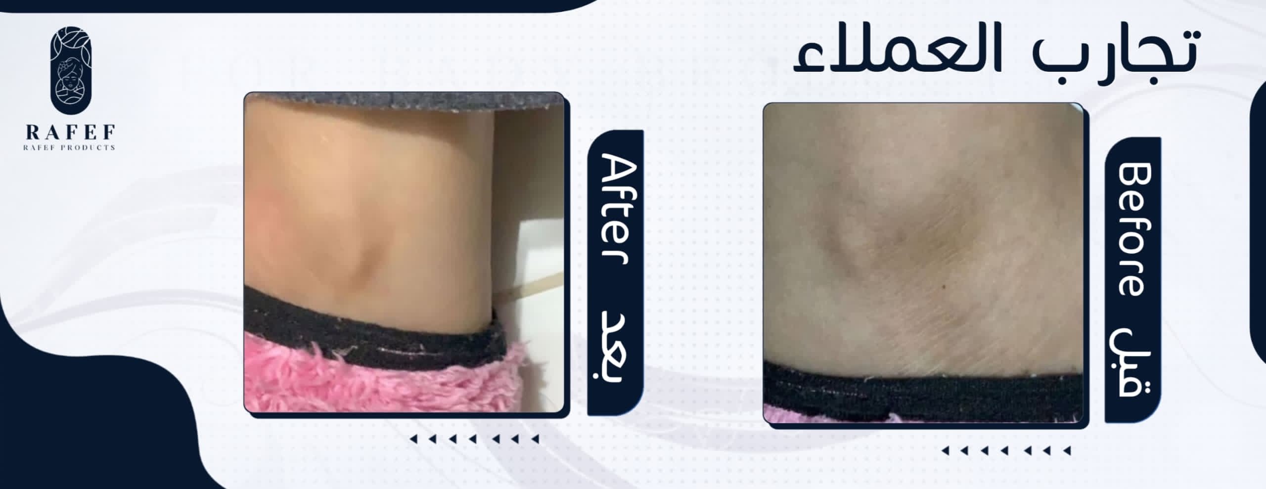 متجر رفيف image-slider-2