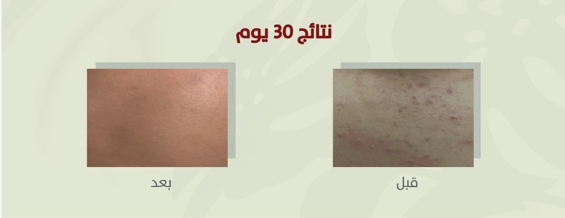 IN ONE image-slider-2