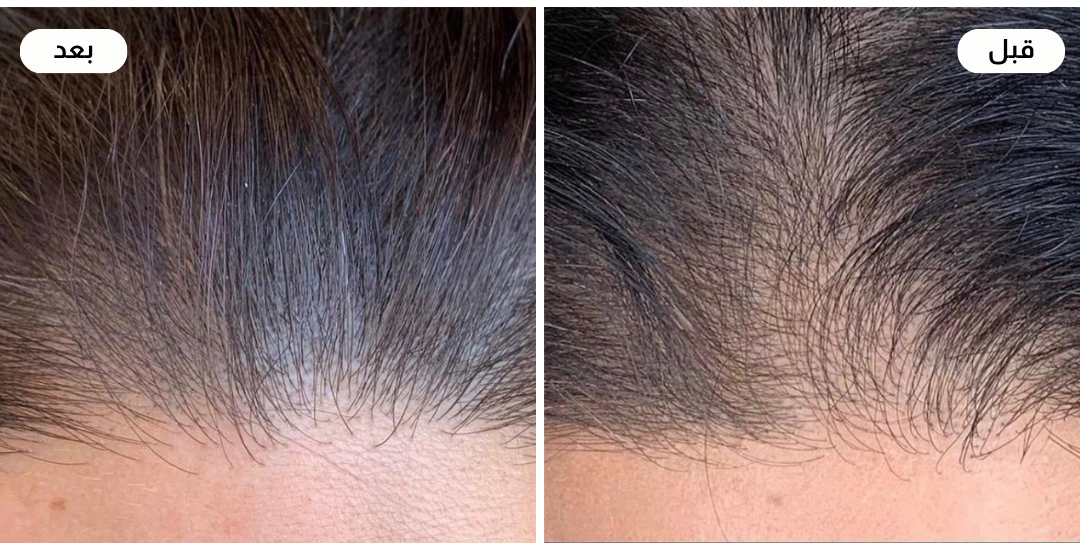 Najla care image-slider-1