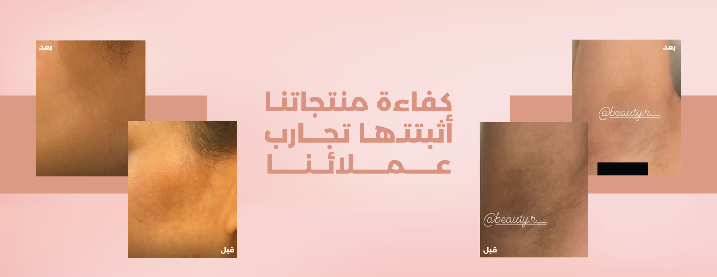 بيوتي آر image-slider-0