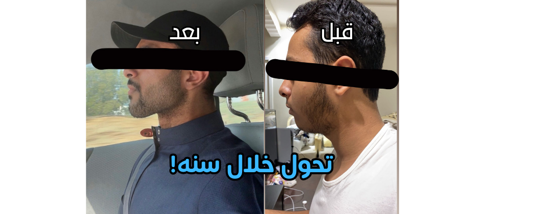 الرجل المتعافي image-slider-0