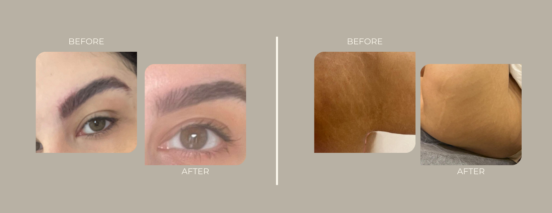 FottyBeauty image-slider-0