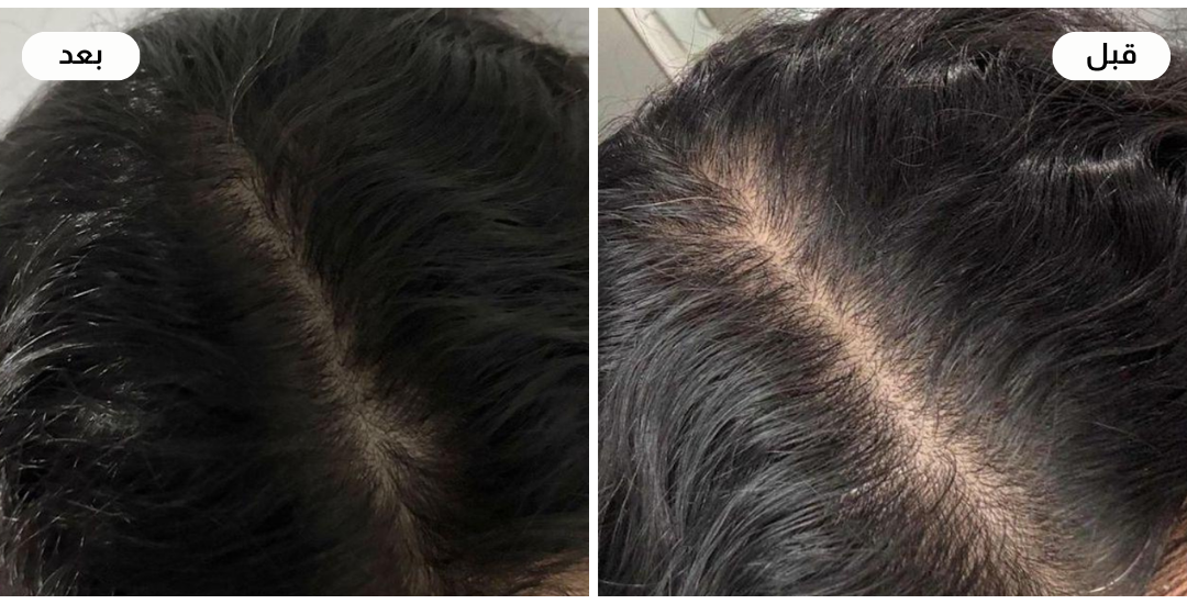 Najla care image-slider-0