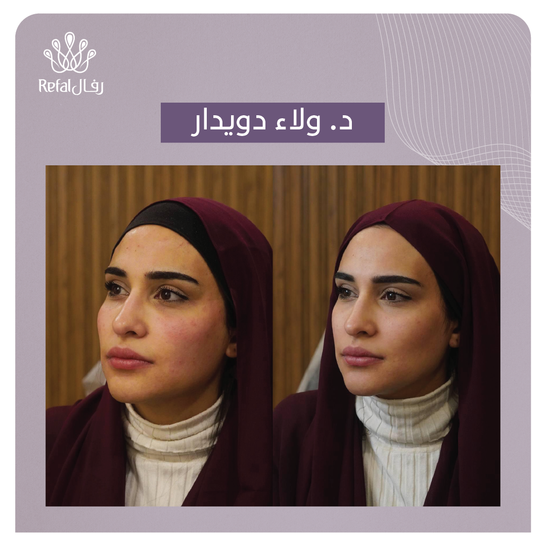 شفتي حالاتنا!