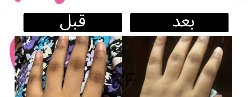 RF image-slider-5