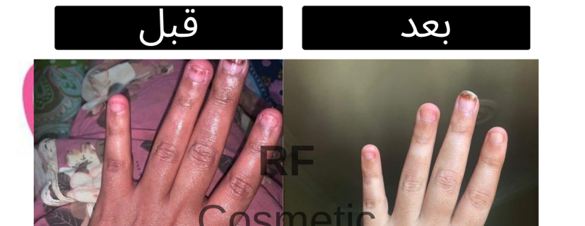 RF image-slider-3