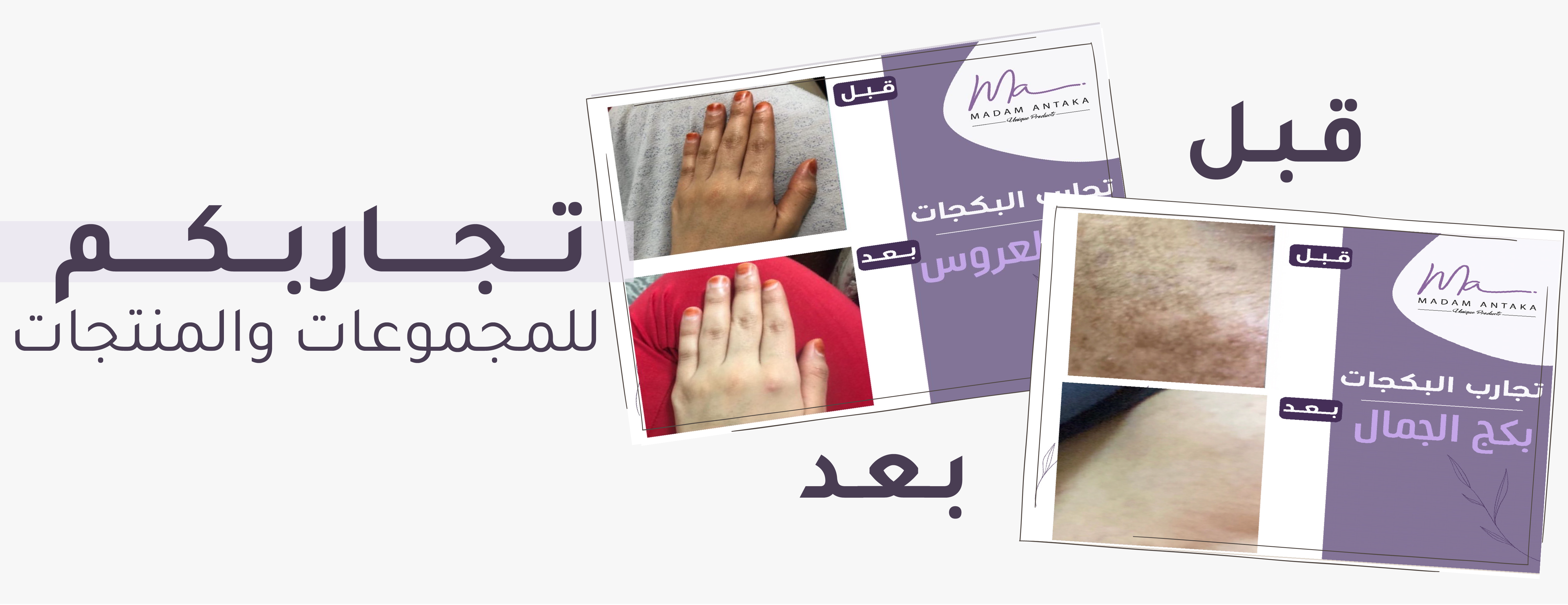 مدام انتكه image-slider-3