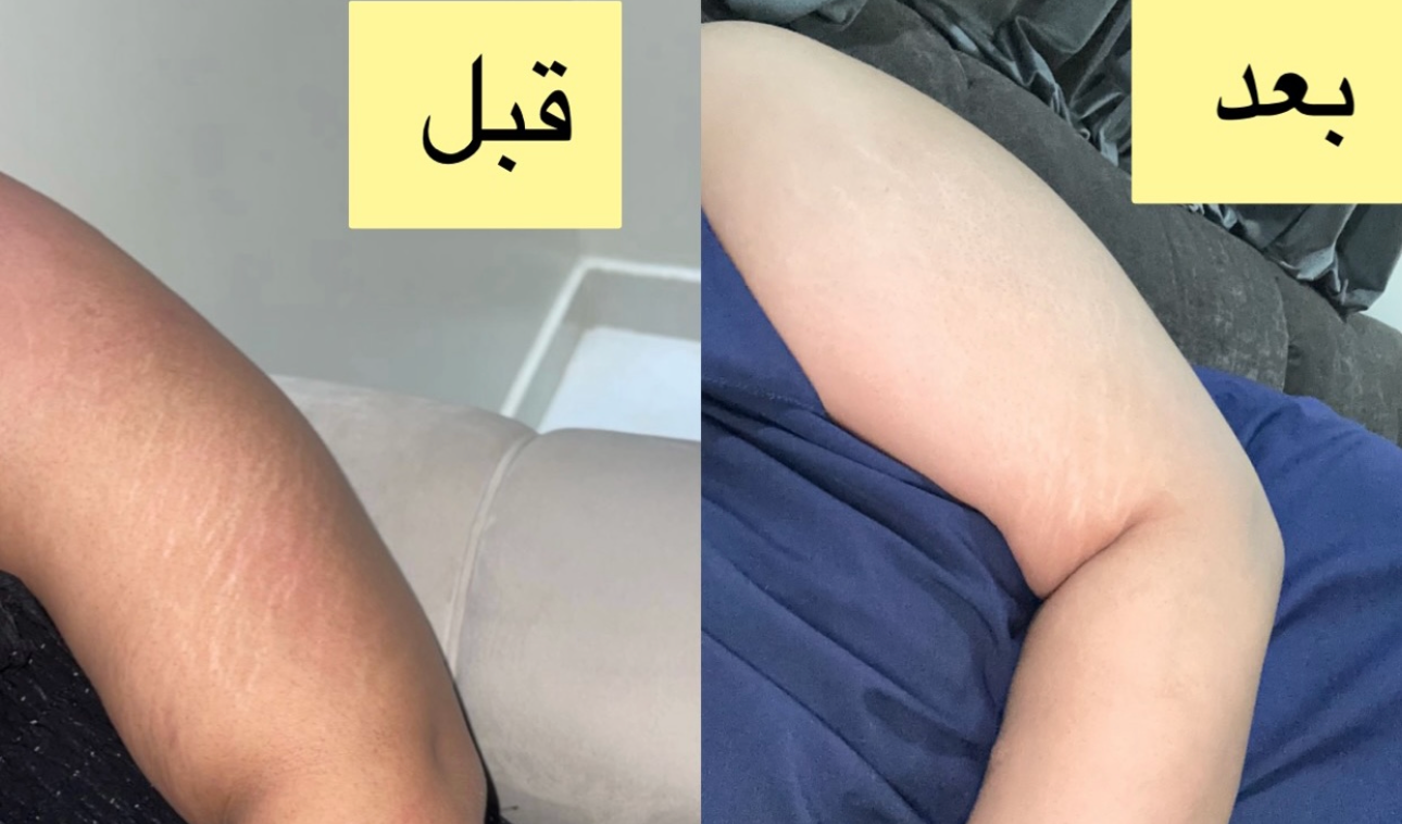fixed banner
