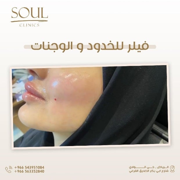Soul clinics image-slider-3