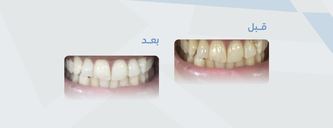 متجر ريفايل image-slider-2