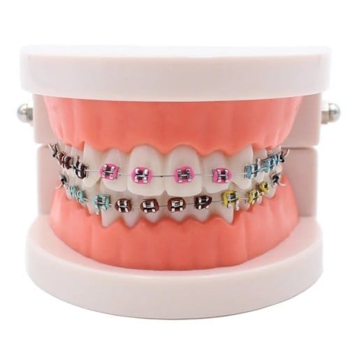 مجسمات الاسنان