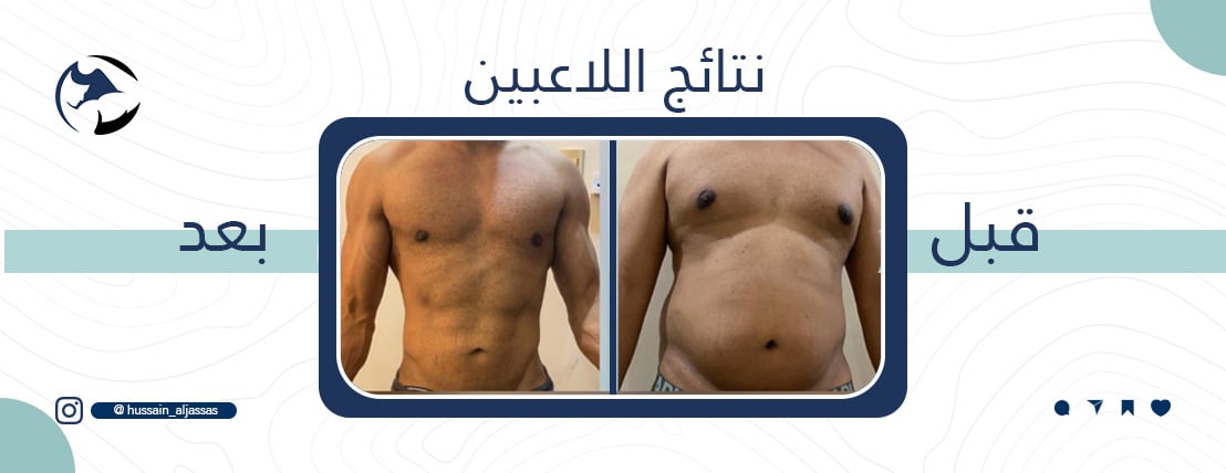 مدرب شخصي حسين جساس image-slider-4