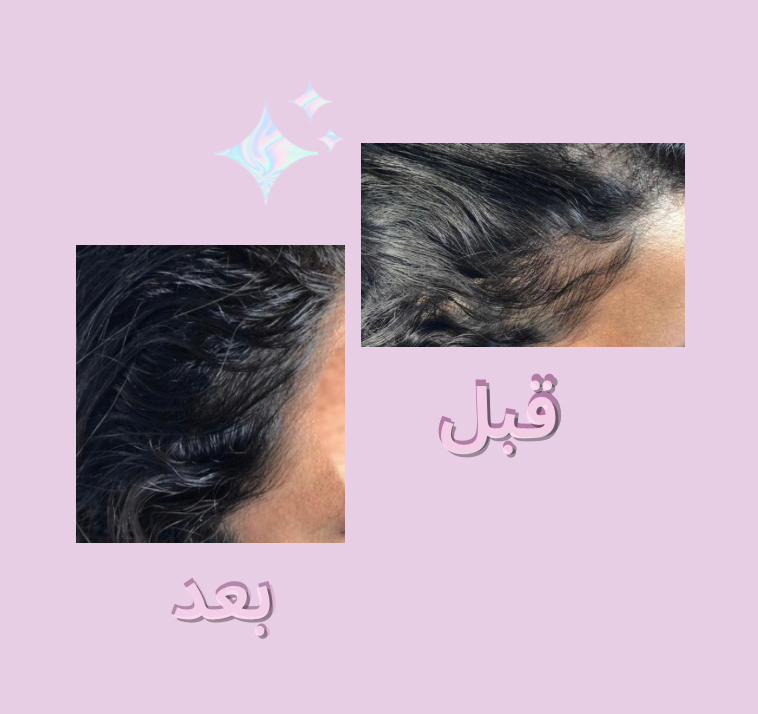 fixed banner