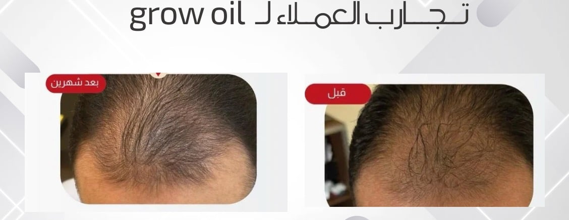 grow oil 99 image-slider-2