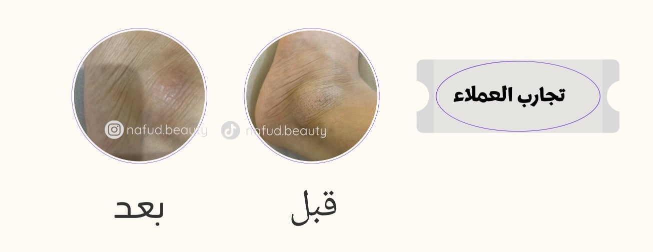 نَفود بيوتي image-slider-1