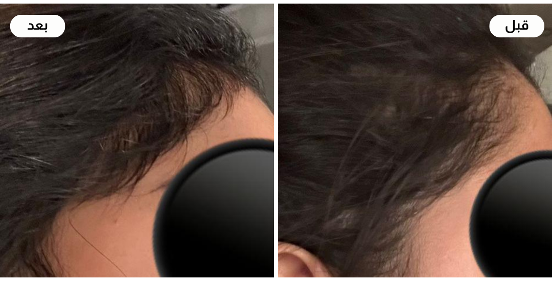 Najla care image-slider-5