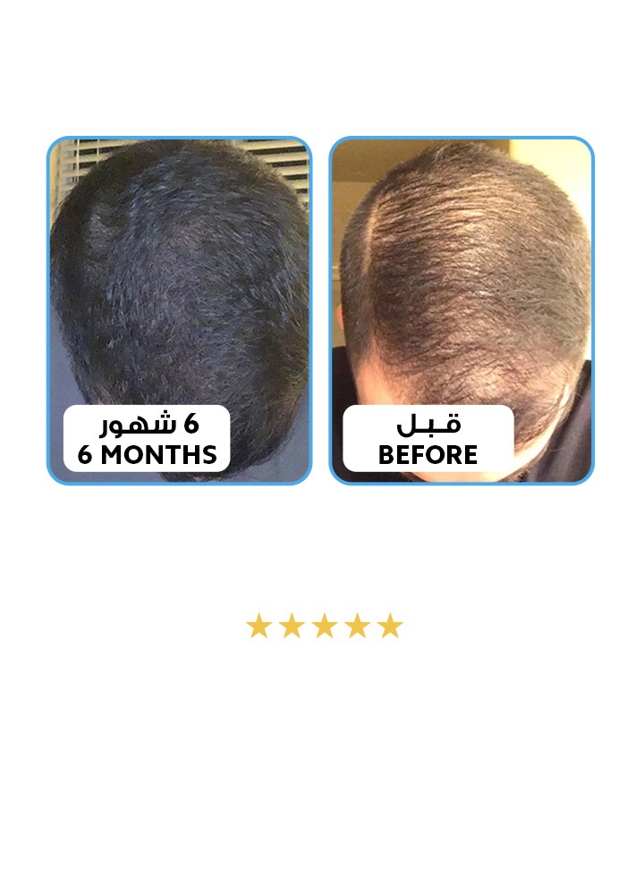 الموند هير للعناية بالشعر | Almond Hair