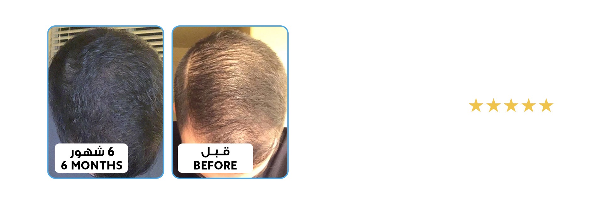 الموند هير للعناية بالشعر | Almond Hair