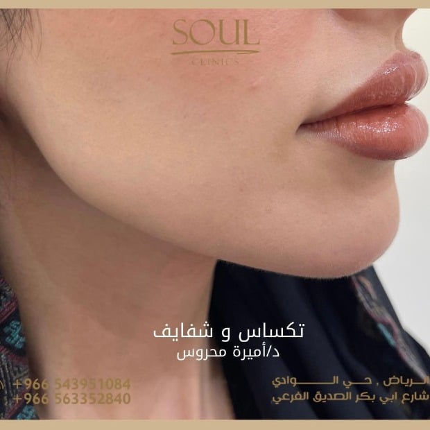 Soul clinics image-slider-2