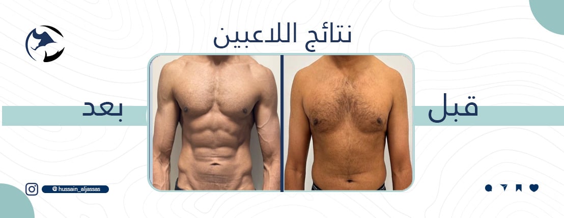 مدرب شخصي حسين جساس image-slider-0