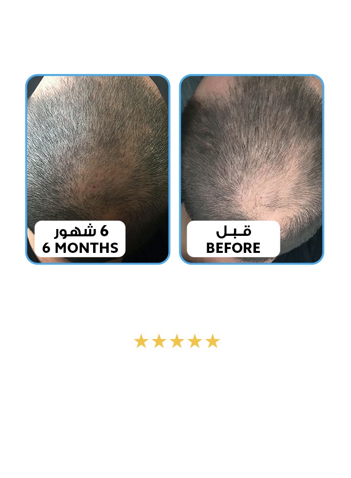 الموند هير للعناية بالشعر | Almond Hair