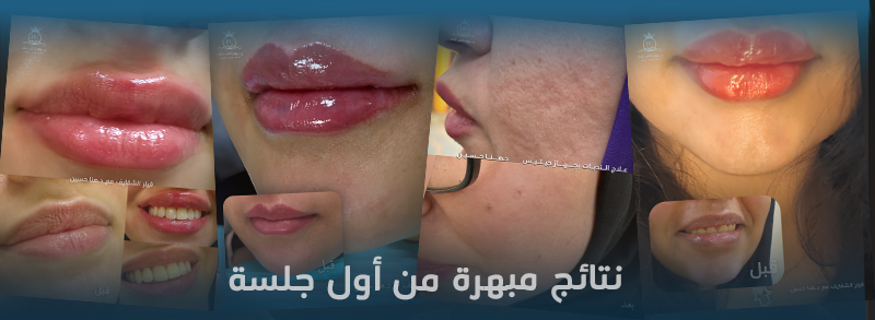خدمات قسم الجلدية و التجميل