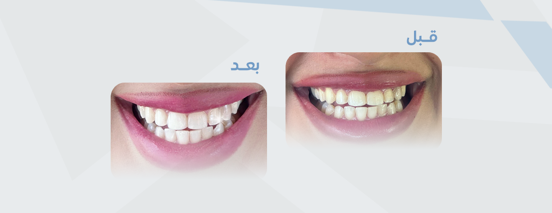 متجر ريفايل image-slider-1