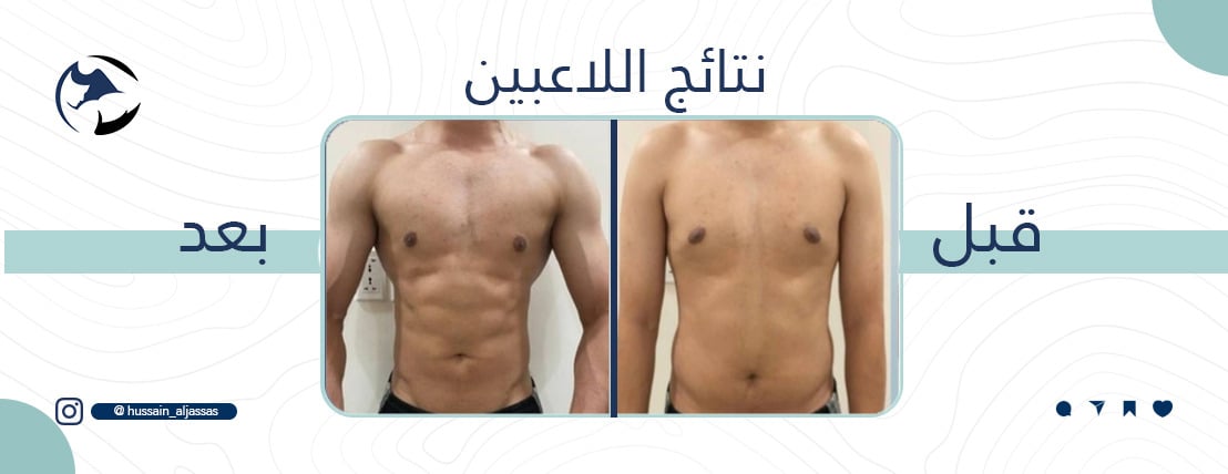 مدرب شخصي حسين جساس image-slider-3