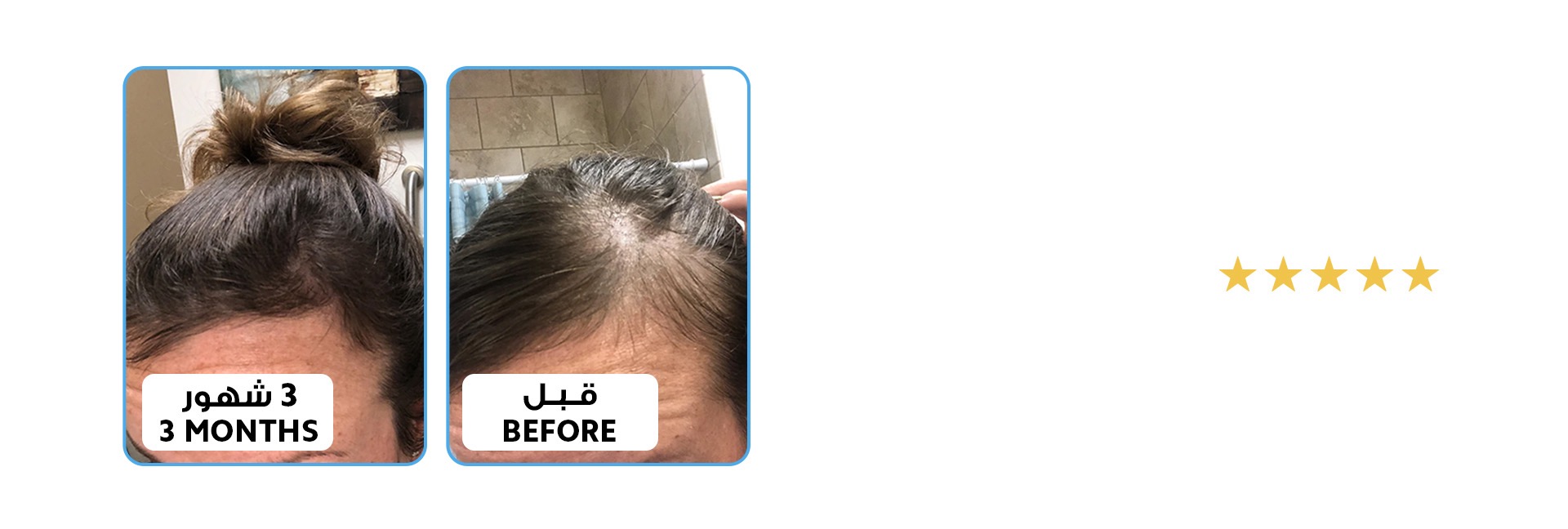 الموند هير للعناية بالشعر | Almond Hair