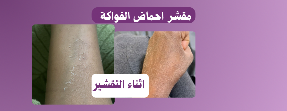 متجر الاوركيد image-slider-2