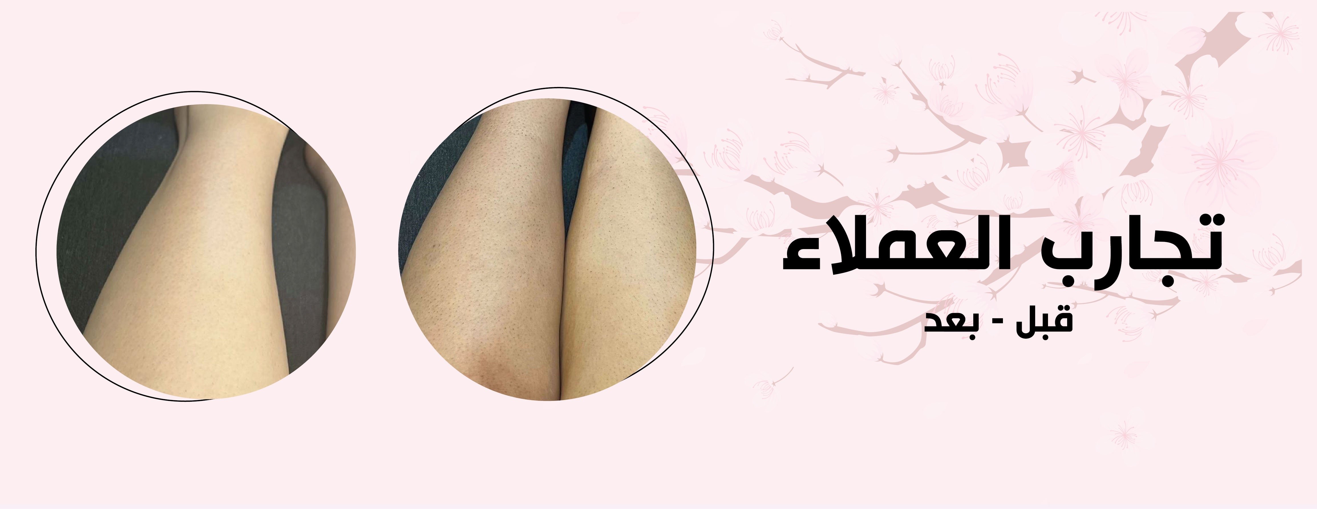 fixed banner
